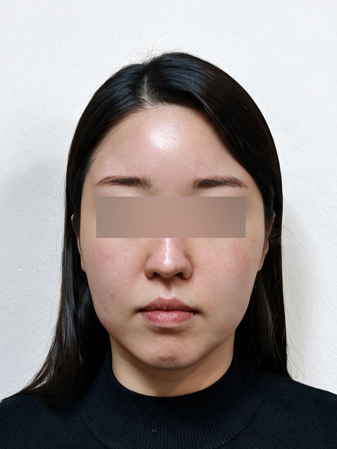 시술 전