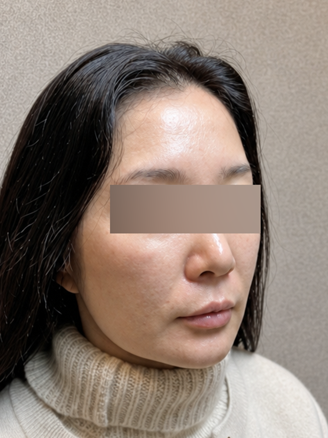 시술 전