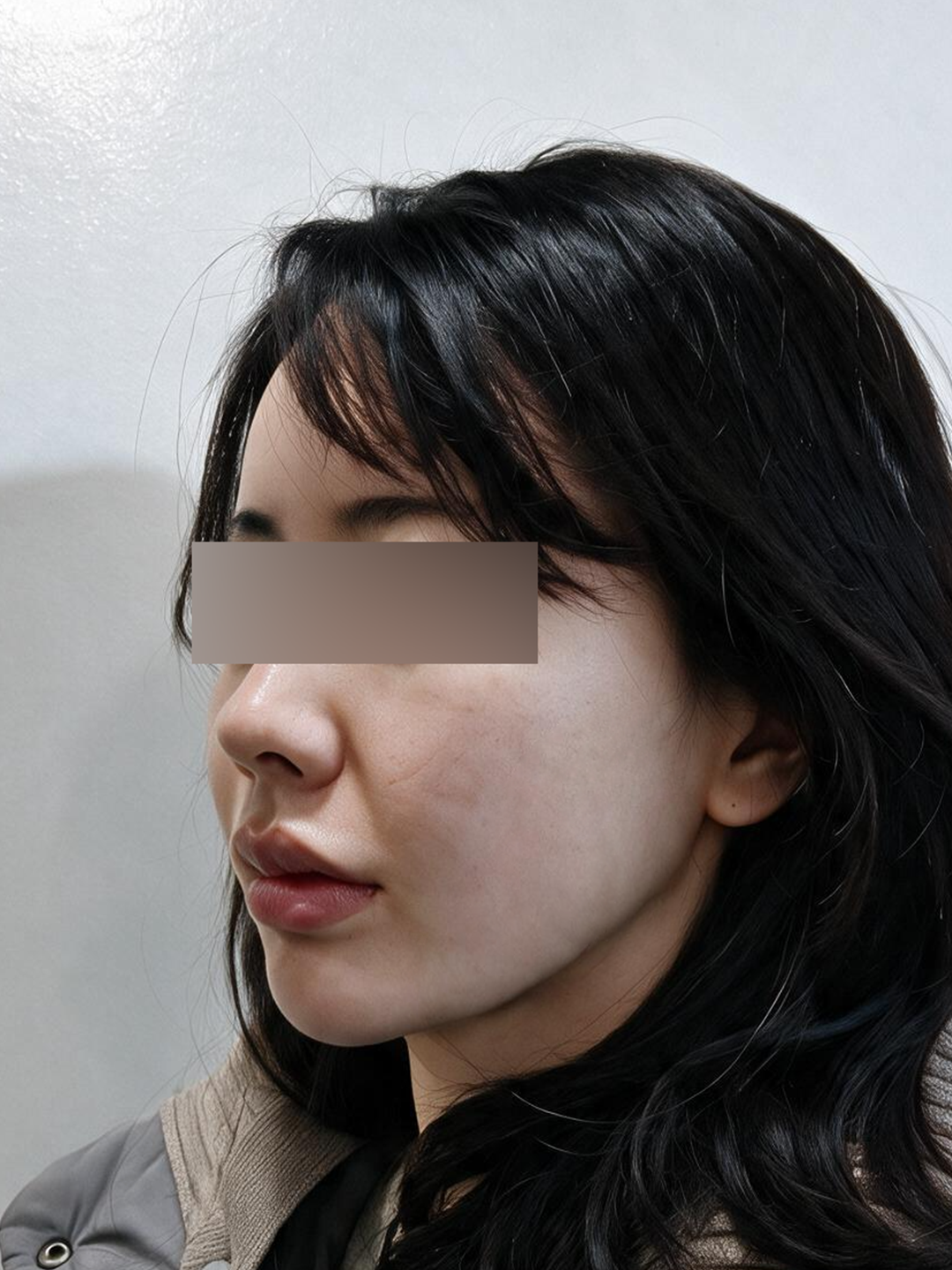 시술 전