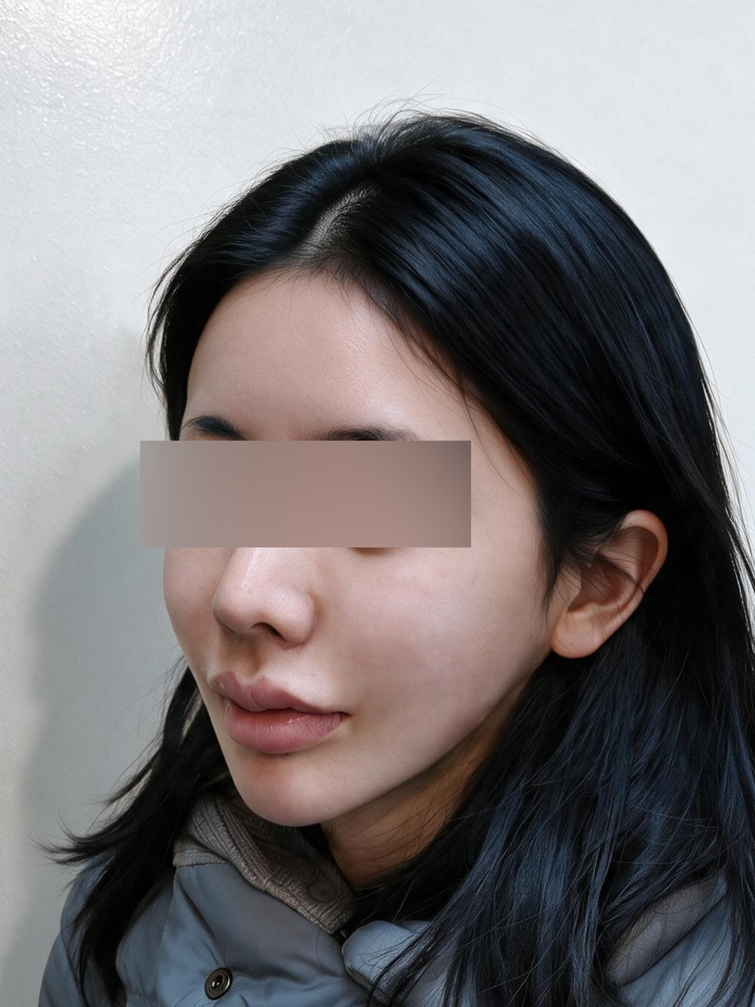 시술 후