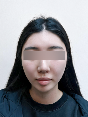 치료 후 이미지