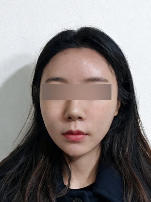 치료 후 이미지