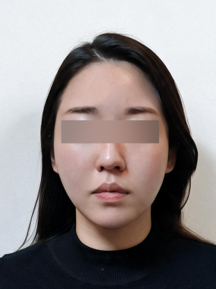 치료 후 이미지