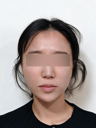 치료 후 이미지